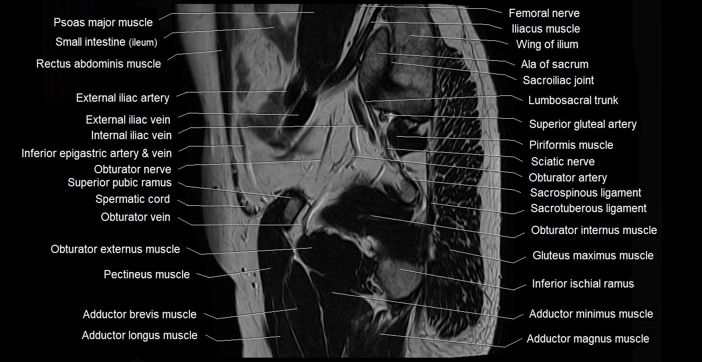 male pelvis sagittal cross sectional anatomy 3T mri image 37.webp